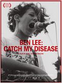 Catch My Disease