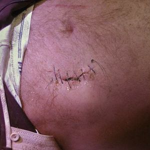 Bilder Dead Next Door