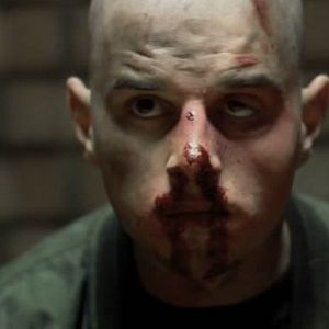 Bilder Skinning - Wir sind das Gesetz