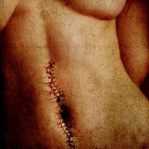 Bilder Stripped - Frisches Fleisch