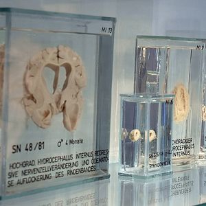 Bilder Das dunkle Gen