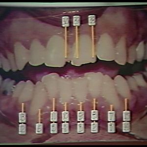 Bilder Ted Bundy: Selbstporträt eines Serienmörders
