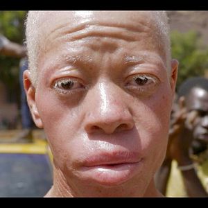 Bilder On Est Ensemble