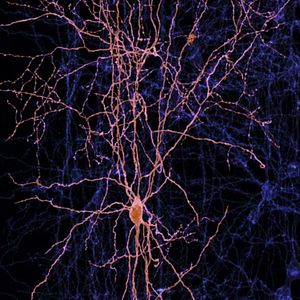 Bilder Aware - Reise in das Bewusstsein