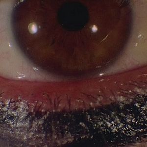 Bilder Rosso - Farbe des Todes