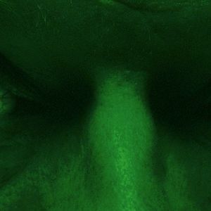 Bilder The Strange Colour Of Your Body's Tears