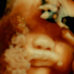 Bilder De Humani Corporis Fabrica