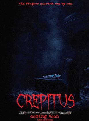  Crepitus