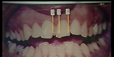 Poster der Serie Burn Bundy Burn