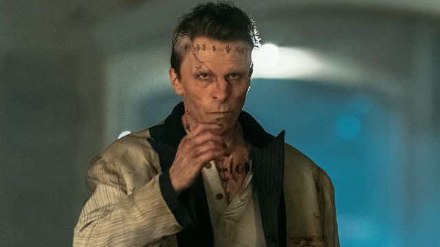 bild aus der news Neuer "Frankenstein"-Film zu brutal fürs Publikum: Darum wurden einige besonders heftige Szenen vor dem Kinostart entschärft!