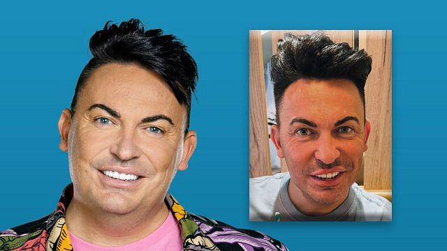 bild aus der news Matthias Mangiapane litt nach Abnehmspritze unter heftigen Nebenwirkungen: So schlecht ging es ihm wirklich