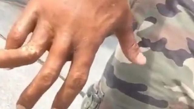 bild aus der news Autsch!!! Dwayne Johnson postet Video von übel gebrochenem Finger