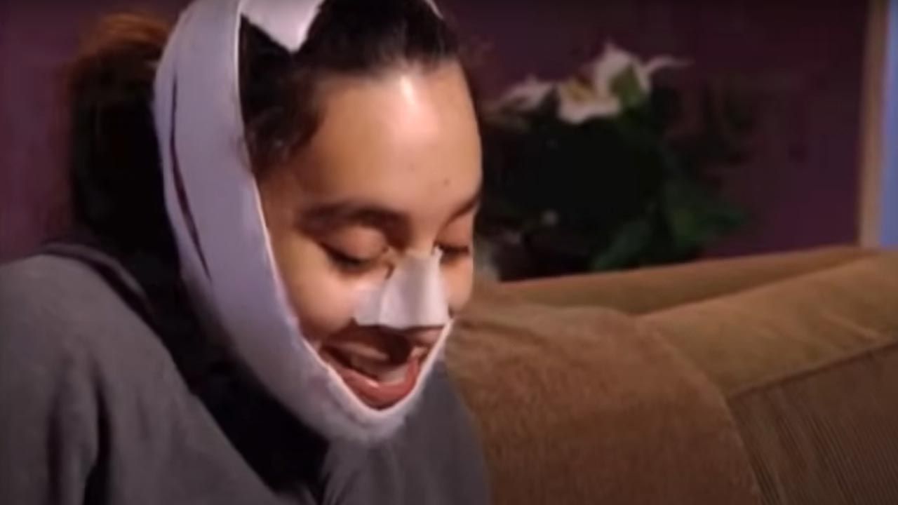 Nach der OP ist vor der OP. Obwohl nach Beauty-Eingriffen normalerweise lange Ruhezeiten verordnet werden, musste bei „The Swan“ alles schnell gehen.