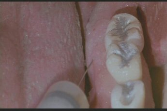 The Dentist : Bild