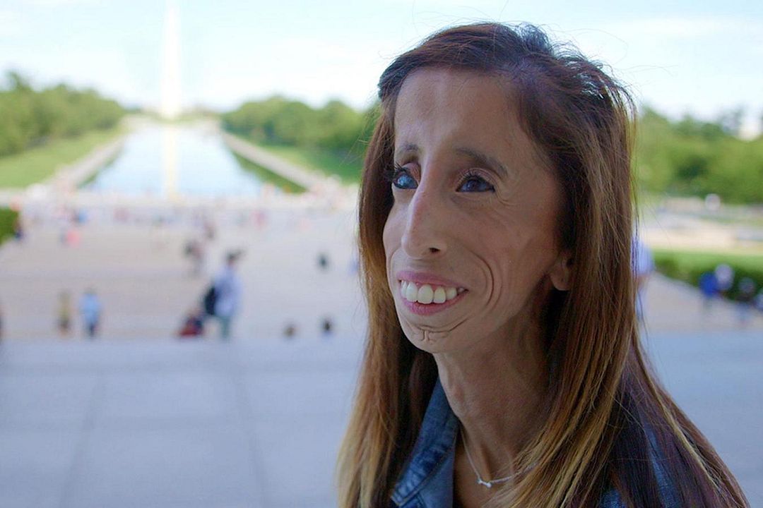 A Brave Heart: The Lizzie Velasquez Story : Bild