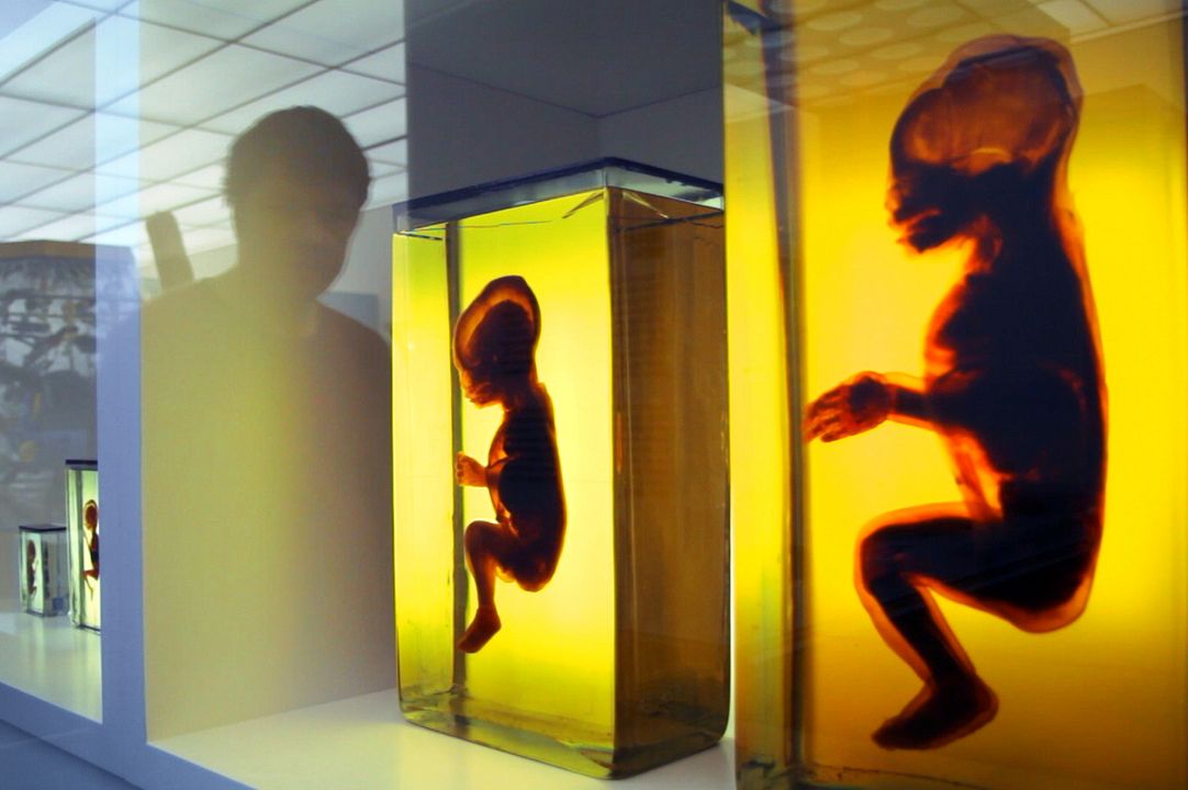 Das dunkle Gen : Bild