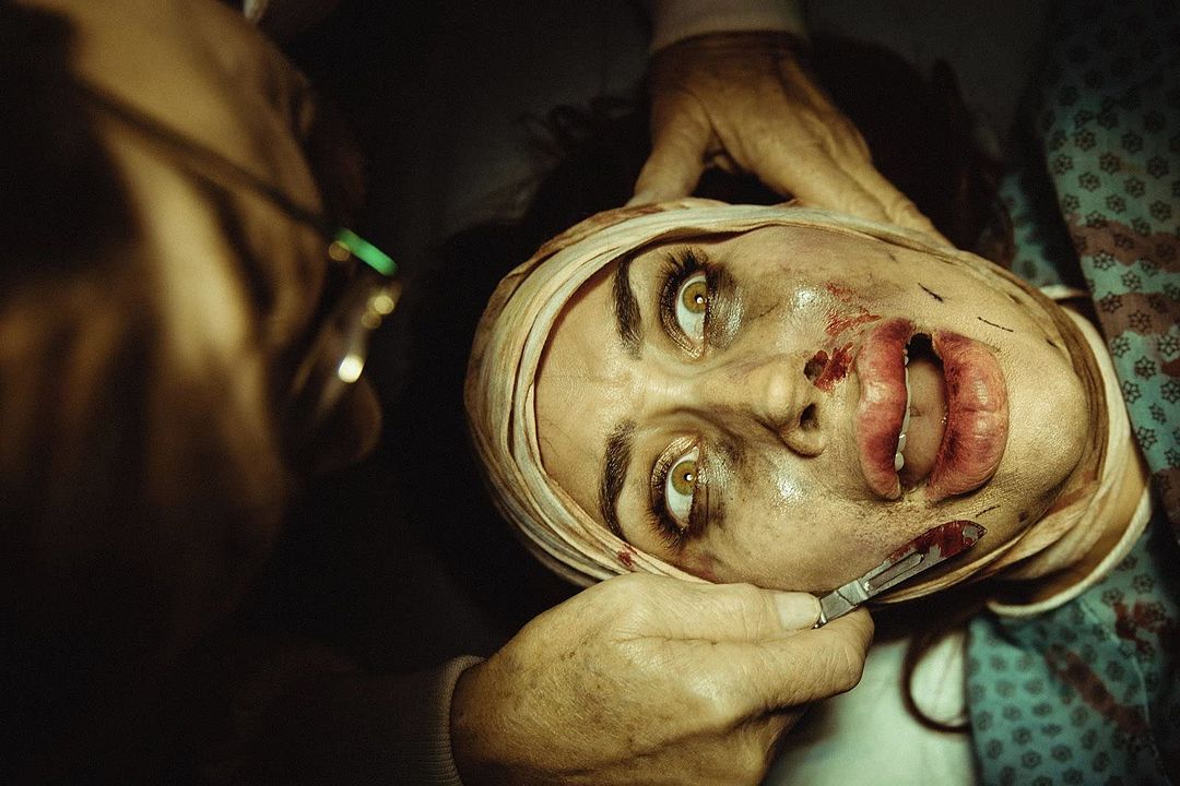 Incision - Kleine Einschnitte, große Schmerzen : Bild